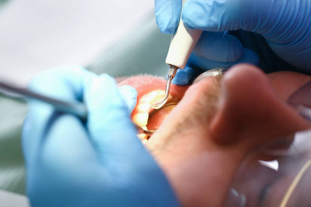 Best Mobile Emergency Dentist in Spencerville, NM